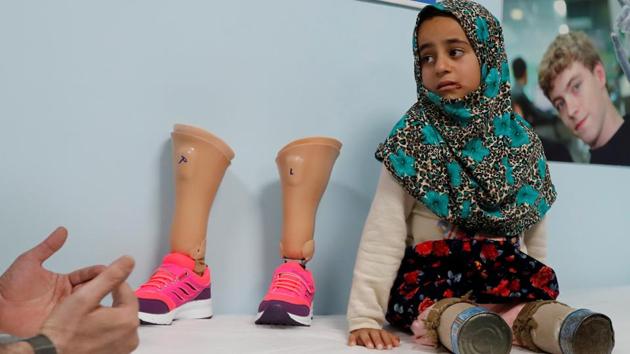 Maya Meri, 8, waits at a prosthetic center in Istanbul, Turkey. (Osman Orsal / REUTERS)