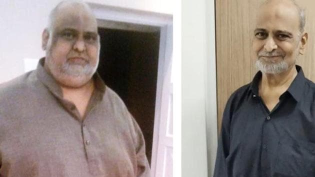 A combo photo of Samyodhin Sajid, before and after his surgery. Weighing 210 kg before surgery, Sajid was not in a position to walk even a few steps out of his house. (HT Photo) A combo photo of Samyodhin Sajid, before and after his surgery. Weighing 210 kg before surgery, Sajid was not in a position to walk even a few steps out of his house. (HT Photo)