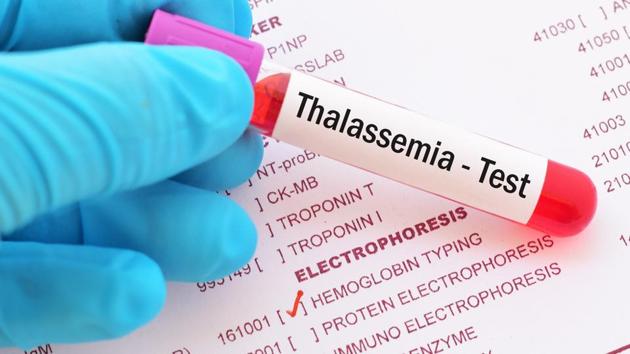 Can this new technique detect and treat thalassemia?(Shutterstock)