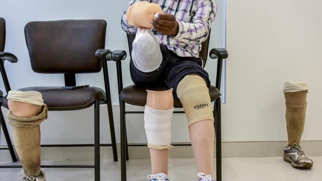 The desire to stand on his feet forced him to take a train back to Mumbai. After arriving the first thing he did was to visit the Ottobock clinic in Chembur which helped him with the artificial limbs. The officials at the center were surprised as how he managed to walk in worn-out limbs for more than 11 years, considering that the prosthetics need upkeep every five years. (Kunal Patil / HT Photo)
