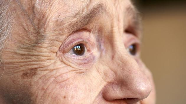 Alzheimer’s and Parkinson’s are the two most common neurological diseases affecting the elderly.(Shutterstock)