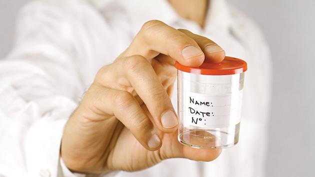 The Punjab health department has devised standard operating procedure (SOP), as per which the hospitals will accept urine samples four days a week . (Image courtesy: Shutterstock) The Punjab health department has devised standard operating procedure (SOP), as per which the hospitals will accept urine samples four days a week . (Image courtesy: Shutterstock)