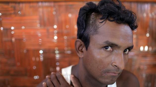 Mohamed Alom, 27, was asleep last month when a torrent of mud crashed through the plastic wall next to him. A tree root slammed into his head, slicing open his skin. Now he and his family are among 13 people living in this one-room schoolhouse. Alom hopes officials will help him build a new shelter, but has no idea how long that will take. (Wong Maye-E / AP) Mohamed Alom, 27, was asleep last month when a torrent of mud crashed through the plastic wall next to him. A tree root slammed into his head, slicing open his skin. Now he and his family are among 13 people living in this one-room schoolhouse. Alom hopes officials will help him build a new shelter, but has no idea how long that will take. (Wong Maye-E / AP)