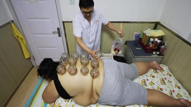 An overweight woman receives fire cupping therapy at a weight loss clinic in Changchun in China's northeastern Jilin province. (AFP) An overweight woman receives fire cupping therapy at a weight loss clinic in Changchun in China's northeastern Jilin province. (AFP)
