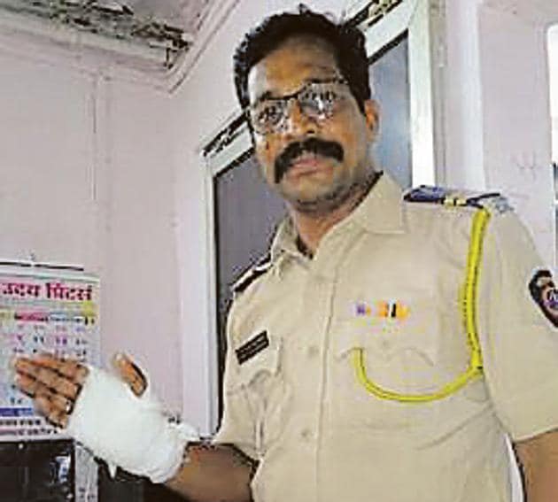 Prashant Mahamunkar, a constable with DN Nagar police station, injured his hand while trying to catch the thieves. (HT Photo) Prashant Mahamunkar, a constable with DN Nagar police station, injured his hand while trying to catch the thieves. (HT Photo)
