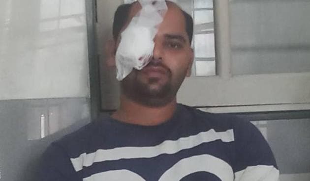 Suraj Gawai, 28, was mauled by the leopard at Rahul Nagar, which is on the periphery of Sanjay Gandhi National Park. Suraj Gawai, 28, was mauled by the leopard at Rahul Nagar, which is on the periphery of Sanjay Gandhi National Park.