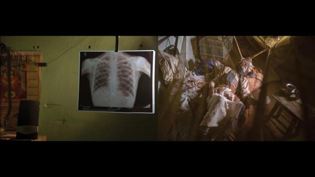 Left: Chilkadand, Right: Vindhyachal, Pipragaon Nayi Basti. “During our time, there was no illness. In the last 10-15 years, it is everywhere. Those days, the water was not like this. Now, the water itself is the illness! My whole body has got jammed like iron. Only my hands move a little. How long can I live like this? ” — Vindhyachal, a 70-year-old patient. (Ruhani Kaur)