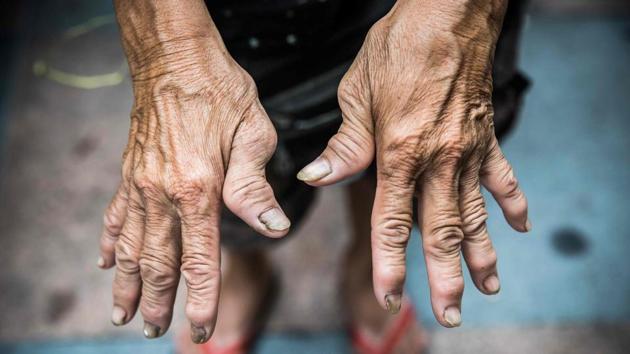 Her fingers are bent from 20 years of collecting cardboard and guiding trolleys loaded with cardboard through the city clogged with traffic and people, but Au Fung-lan says she has no desire to give up this gruelling work. (Issac Lawrence / AFP) Her fingers are bent from 20 years of collecting cardboard and guiding trolleys loaded with cardboard through the city clogged with traffic and people, but Au Fung-lan says she has no desire to give up this gruelling work. (Issac Lawrence / AFP)