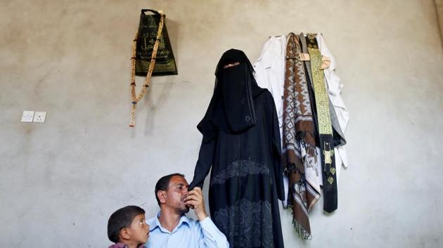 Khaled Ismael kisses the hand of his daughter, Radhiya, 17, who had her left arm amputated due to cancer, in Amran, Yemen. “I spent all our valuables and had to borrow a lot of money to cover the expenses,” Ismael said. “Because of our inability to travel abroad, my daughter did not get enough treatment and her arm had to be amputated,” he added. “The war has devastated our lives.” (Khaled Abdullah / REUTERS)