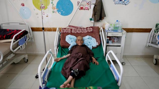 The few beds available at the centre are reserved for children. Other patients receive treatment intravenously, while sitting on dilapidated recliner chairs or in the waiting area. (Khaled Abdullah / REUTERS)