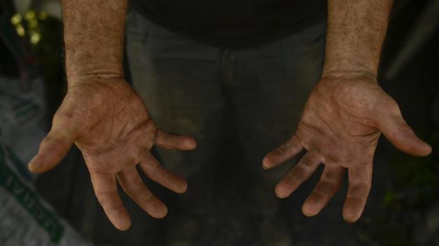 Miguel Lander shows his hands as he works making traditional charcoal. “Everybody in the village knew that charcoal-making was all they could expect in life,” Galdeano said, now retired. The trade, he adds, was “tough, very tough.” (Alvaro Barrientos / AP) Miguel Lander shows his hands as he works making traditional charcoal. “Everybody in the village knew that charcoal-making was all they could expect in life,” Galdeano said, now retired. The trade, he adds, was “tough, very tough.” (Alvaro Barrientos / AP)