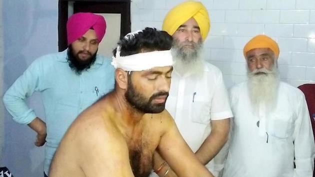 SAD worker Anakhpreet Singh, injured during clash with congress workers, admitted at Civil hospital in Tarn Taran on Wednesday.(HT Photo)