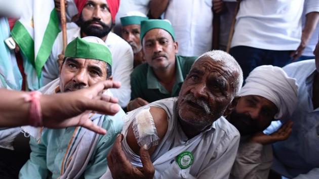 A farmer shows injuries sustained during police action. BKU leaders have also demanded that diesel tractors should be kept out of the ambit of National Green Tribunal’s directions that mandate the removal of all diesel vehicles older than 10 years from the National Capital Region. (Burhaan Kinu / HT Photo) A farmer shows injuries sustained during police action. BKU leaders have also demanded that diesel tractors should be kept out of the ambit of National Green Tribunal’s directions that mandate the removal of all diesel vehicles older than 10 years from the National Capital Region. (Burhaan Kinu / HT Photo)