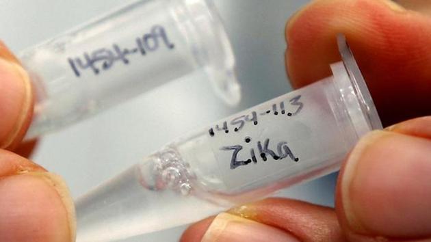 Pune city was exposed to this virus in 1964-1967, so we know the chances of spotting or seeing Zika positive case cannot be denied in the future; but we cannot say that it will enter from other parts of the country, or from a patient who have a travel history to Zika- affected countries (HT FILE/ REUTERS) Pune city was exposed to this virus in 1964-1967, so we know the chances of spotting or seeing Zika positive case cannot be denied in the future; but we cannot say that it will enter from other parts of the country, or from a patient who have a travel history to Zika- affected countries (HT FILE/ REUTERS)