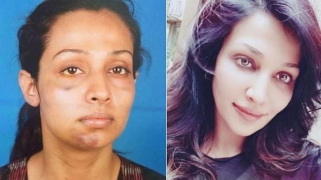 Flora Saini also shared a photo where injuries are visible on her face.