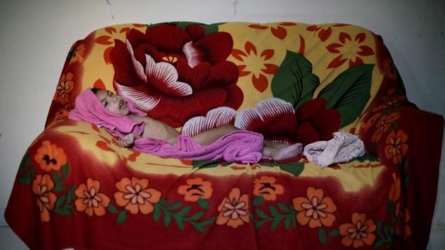 Luana Vieira, who is two years old, and was born with microcephaly, lies on a sofa after bath at her house in Brazil. WHO officials fear a Zika virus spread to new populations. In Angola, dozens of babies born with microcephaly since 2017 appear linked to the same strain of Zika that hit Latin America. (Ueslei Marcelino / REUTERS)