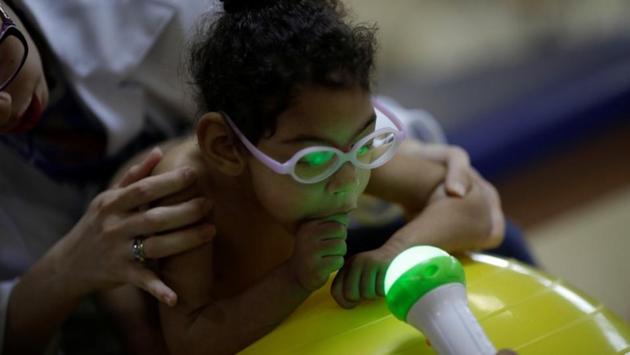 Luana Vieira, who is two years old, and was born with microcephaly, reacts to stimulus during an evaluation session with a physiotherapist at the Altino Ventura rehabilitation center in Recife, Brazil. (Ueslei Marcelino / REUTERS)