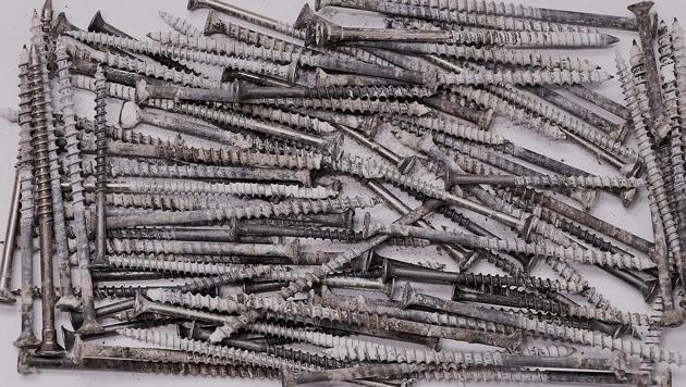 The 33-year-old patient suffers from mental illness and had apparently consumed the items, including 122 four inch (10 centimetre) nails, four pins, a toothpick and pieces of broken glass (Representational Image) The 33-year-old patient suffers from mental illness and had apparently consumed the items, including 122 four inch (10 centimetre) nails, four pins, a toothpick and pieces of broken glass (Representational Image)