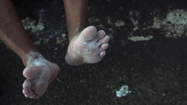 The migrants, many of them with blistered and bandaged feet, left the southern city of Tapachula early afternoon Monday, bound for Huixtla. In interviews along the journey, migrants have said they are fleeing widespread violence, poverty and corruption. The caravan is unlike previous mass migrations for its unprecedented large numbers and because it largely sprang up spontaneously through word of mouth. (Oliver de Roos / AP) The migrants, many of them with blistered and bandaged feet, left the southern city of Tapachula early afternoon Monday, bound for Huixtla. In interviews along the journey, migrants have said they are fleeing widespread violence, poverty and corruption. The caravan is unlike previous mass migrations for its unprecedented large numbers and because it largely sprang up spontaneously through word of mouth. (Oliver de Roos / AP)