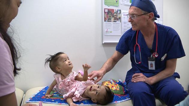Australian surgeons began operating to separate the 15-month-old Bhutanese twins joined at the torso.(AFP)