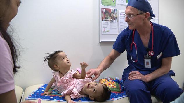 Australian surgeons began operating to separate the 15-month-old Bhutanese twins joined at the torso. (AFP) Australian surgeons began operating to separate the 15-month-old Bhutanese twins joined at the torso. (AFP)