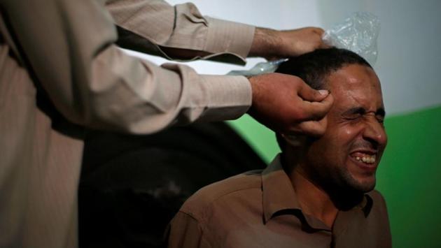 A patient who suffers from nerve problems receives bee-sting therapy by Haj Omar Abulhassan at the treatment room of his home in Cairo, Egypt. On his rooftop, Abulhassan raises thousands of bees -- not for the honey, but their venom. (Amr Abdallah Dalsh / REUTERS) A patient who suffers from nerve problems receives bee-sting therapy by Haj Omar Abulhassan at the treatment room of his home in Cairo, Egypt. On his rooftop, Abulhassan raises thousands of bees -- not for the honey, but their venom. (Amr Abdallah Dalsh / REUTERS)