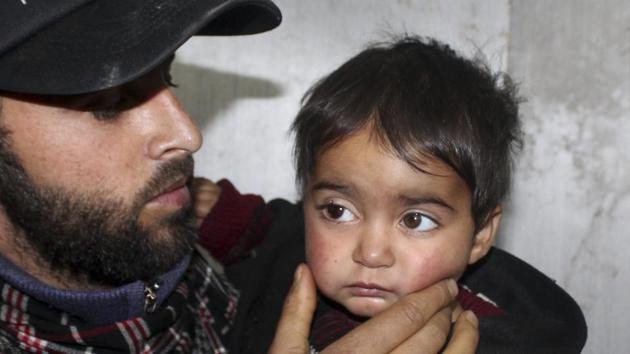 Nineteen-month old Hiba Nisar, the youngest pellet victim in Kashmir, is held by her father Nissar Ahmad Bhat as she undergoes treatment at SMHS Hospital in Srinagar, Sunday, Nov 25, 2018.(PTI)
