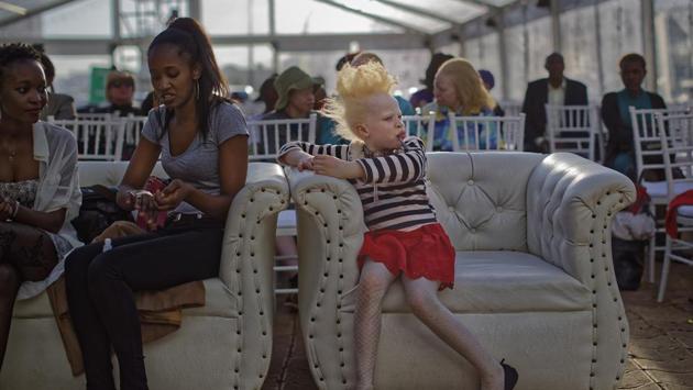 Rebecca Zawadi, 8, (R) sits next to Marion Jacklin, (C-L), who helped train the contestants. “The threat has reduced greatly, but it’s still there,” James said. The competition for 30 participants was organized by the Albinism Society of Kenya with partners in Uganda and Tanzania. (Ben Curtis / AP)