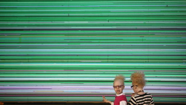 Shirlyne 7, (L), and Rebecca Zawadi, 8, (R), stand by a large television screen as they wait for the start of the contest. Albinism is said to be more prevalent in sub-Saharan Africa than elsewhere. The UN estimates that 1 in 1,400 people are affected in Tanzania and 1 in 1,000 in Zimbabwe. (Ben Curtis / AP)