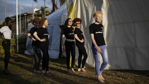 Contestants practice their catwalk moves on the day of the event. Albinism is a rare, non-contagious, inherited condition leading to a lack of pigmentation in the hair, skin and eyes, causing vulnerability to the sun and bright light. (Ben Curtis / AP)