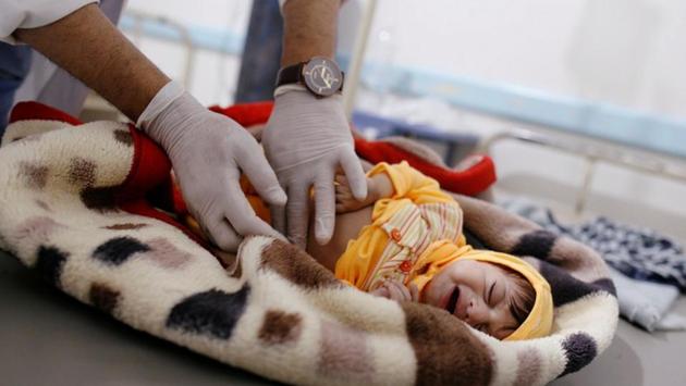 A doctor checks an infected child. The World Health Organization (WHO) warned in October that the outbreak is accelerating again with roughly 10,000 suspected cases now reported per week, double the average rate for the first eight months of 2018. Most cases have been reported in areas held by the Houthi movement, which controls most population centres after ousting the government from Sanaa in 2014. (Khaled Abdullah / REUTERS) 
