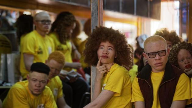 A contestant watches as another performs during a rehearsal for the Mr. & Miss Albinism East Africa competition, a couple of days prior to the event. A groundbreaking beauty pageant, the first Mr. and Miss Albinism East Africa pageant also saw participants from Tanzania and Uganda. (Ben Curtis / AP)