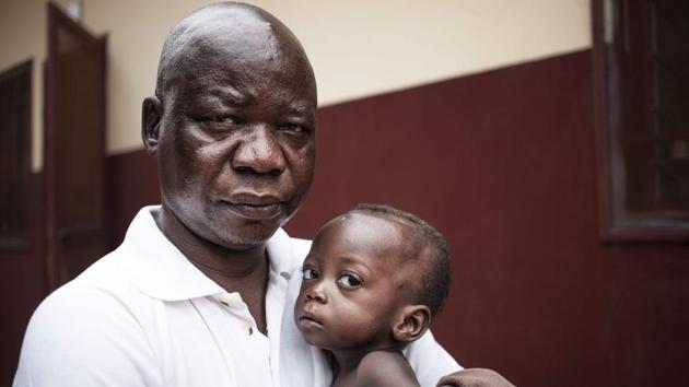 In the overcrowded hospital grounds, Theodore hugged his malnutritioned daughter. His wife is in hospital after having a nervous breakdown after the couple’s first child died. He struggles to earn enough money to buy food. In general, children are hospitalised for a little over a week until their weight recovers. But not all survive, with some losing to severe malnutrition or disease. (Florent Vergnes / AFP) In the overcrowded hospital grounds, Theodore hugged his malnutritioned daughter. His wife is in hospital after having a nervous breakdown after the couple’s first child died. He struggles to earn enough money to buy food. In general, children are hospitalised for a little over a week until their weight recovers. But not all survive, with some losing to severe malnutrition or disease. (Florent Vergnes / AFP)