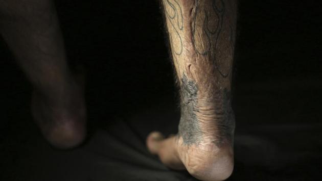 “The flames express the fire still raging inside me for my loss.” Khudeir survived both bombings, but was left with gruesome scars. “People stared at me, and sometimes I felt they were scared of me at the swimming pool,” the 36-year-old said. Over a period of four years he spent some $2,500 on tattoos, which now cover most of his body. (Hadi Mizban / AP) “The flames express the fire still raging inside me for my loss.” Khudeir survived both bombings, but was left with gruesome scars. “People stared at me, and sometimes I felt they were scared of me at the swimming pool,” the 36-year-old said. Over a period of four years he spent some $2,500 on tattoos, which now cover most of his body. (Hadi Mizban / AP)