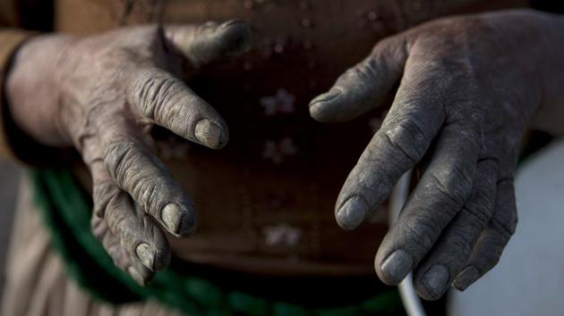 69-year-old farmer Celia’s hands are covered in soil after working her vegetable crops, which are irrigated with sewage water. The contamination is also a problem in rivers in other Bolivian cities such as Cochabamba and Santa Cruz, where 65% of Bolivia’s 11 million people live. Mining often pollutes waterways in smaller cities. (Juan Karita / AP) 69-year-old farmer Celia’s hands are covered in soil after working her vegetable crops, which are irrigated with sewage water. The contamination is also a problem in rivers in other Bolivian cities such as Cochabamba and Santa Cruz, where 65% of Bolivia’s 11 million people live. Mining often pollutes waterways in smaller cities. (Juan Karita / AP)