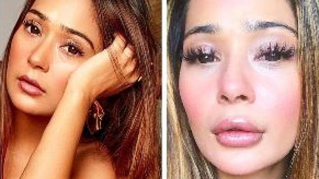 Actor Sara Khan recently posted a photo of herself where her lips are looking fuller (right) and soon people started posting negative comments on her post.