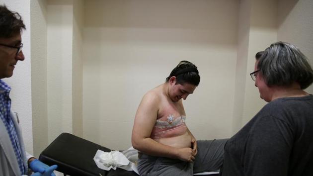 Gabriel Diaz de Tudanca, 18, reacts next to his mother Mariely and surgeon Jesus Lago upon seeing his chest for the first time after undergoing female to male chest reconstruction surgery on November 2, 2016. “My life changed completely after the chest removal operation. No more binders, no more neoprene suits, no more hiding. For the first time I felt free,” Diaz de Tudanca said. (Susana Vera / REUTERS) Gabriel Diaz de Tudanca, 18, reacts next to his mother Mariely and surgeon Jesus Lago upon seeing his chest for the first time after undergoing female to male chest reconstruction surgery on November 2, 2016. “My life changed completely after the chest removal operation. No more binders, no more neoprene suits, no more hiding. For the first time I felt free,” Diaz de Tudanca said. (Susana Vera / REUTERS)