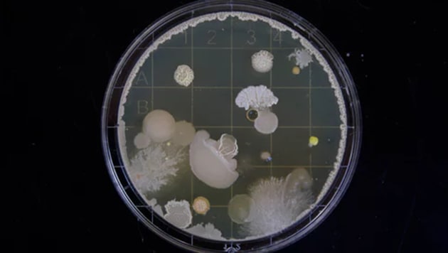 Bacteria samples(Representative Image/ File Photo)