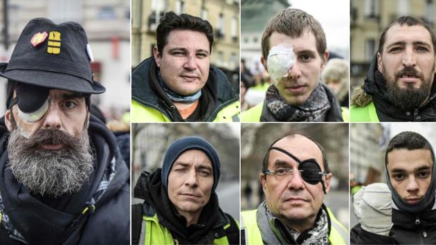 This combination of pictures shows Jerome Rodrigues (L), one of the leading figures of the “yellow vest” movement who claims to have been hit in the eye by a rubber bullet during clashes at the Bastille square in Paris and six protesters, who claim to have been injured by police during the last three months demonstrations in France. (AFP)
