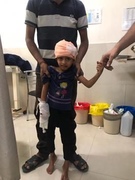 Six-year-old Sejal Yadav fell from a building construction site onto a protruding metallic rod, which pierced her skull, in Chembur. (HT PHOTO) Six-year-old Sejal Yadav fell from a building construction site onto a protruding metallic rod, which pierced her skull, in Chembur. (HT PHOTO)