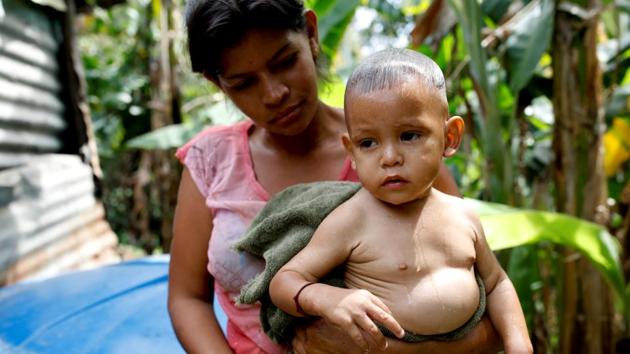Some aid agencies like Catholic relief agency Caritas are already on the ground providing what help they can. In San Francisco de Yare, a town 70 km south of Caracas, Maria Guitia’s one-year-old baby’s belly is distended and his arms thin. The pair live with Guitia’s five siblings and parents in a one-room tin shed with a dirt floor and no running water. (Carlos Garcia Rawlins / REUTERS) Some aid agencies like Catholic relief agency Caritas are already on the ground providing what help they can. In San Francisco de Yare, a town 70 km south of Caracas, Maria Guitia’s one-year-old baby’s belly is distended and his arms thin. The pair live with Guitia’s five siblings and parents in a one-room tin shed with a dirt floor and no running water. (Carlos Garcia Rawlins / REUTERS)