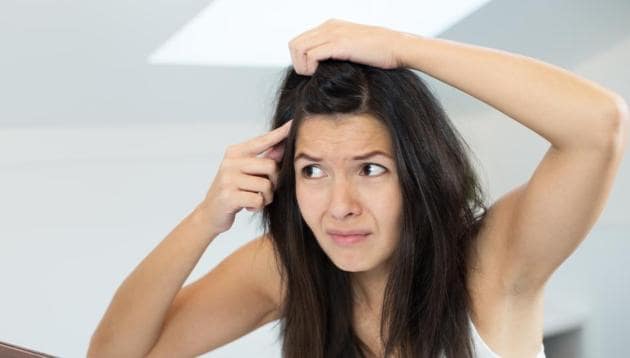 A flaky, itchy condition could be both due to a dry or an oily scalp.(Shutterstock)