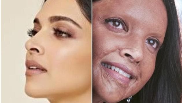 Deepika Padukone’s character in Chhapaak is based on acid attack survivor Laxmi Agarwal.