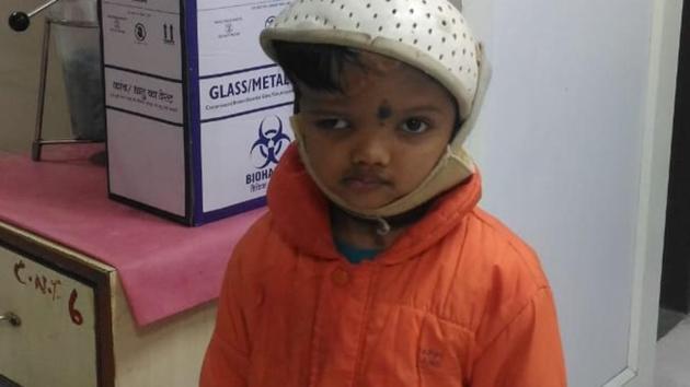 Jagga (in pic) and his twin brother Baliya were born with joined heads. They were operated upon at AIIMS in 2017 to separate them. (HT Photo) Jagga (in pic) and his twin brother Baliya were born with joined heads. They were operated upon at AIIMS in 2017 to separate them. (HT Photo)