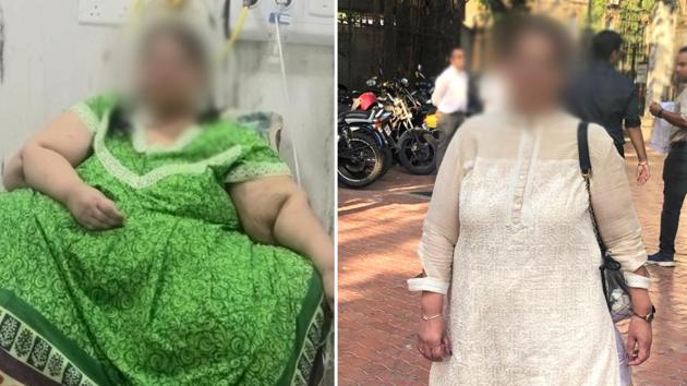 Amita Rajani weighed 300kg (left) before the surgeries. She now weighs 85kg. (HT Photo) Amita Rajani weighed 300kg (left) before the surgeries. She now weighs 85kg. (HT Photo)