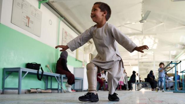 Ahmad Sayed Rahman, a five-year-old Afghan boy who lost his right leg when he was hit by a bullet in the crossfire of a battle, dances with his prosthetic leg at the International Committee of the Red Cross (ICRC) hospital for war victims and the disabled, in Kabul, Afghanistan. (Wakil Kohsar / AFP) Ahmad Sayed Rahman, a five-year-old Afghan boy who lost his right leg when he was hit by a bullet in the crossfire of a battle, dances with his prosthetic leg at the International Committee of the Red Cross (ICRC) hospital for war victims and the disabled, in Kabul, Afghanistan. (Wakil Kohsar / AFP)