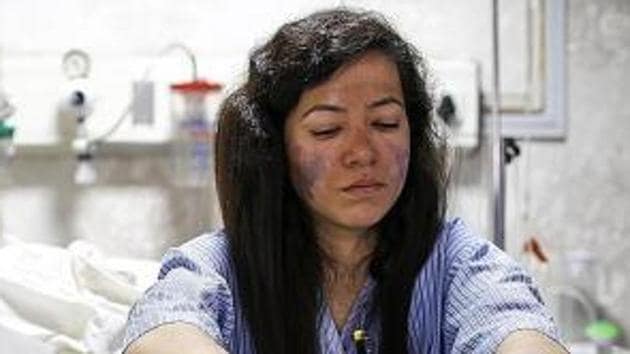 Ameesha Chauhan, a survivor of the Everest “traffic jam” who is recovering from frostbite, said climbers without basic skills should be barred.(AFP Photo)