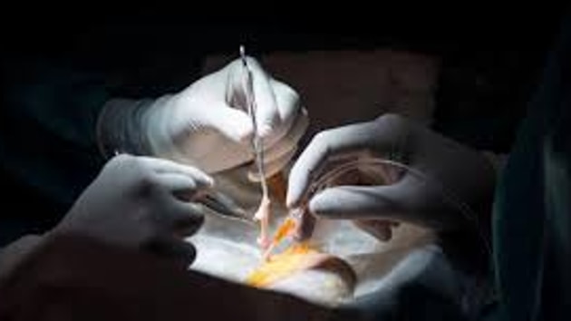 The surgery took place around 2.30pm, and she was moved into the surgical ward at the sixth floor of the main building at the trauma centre. (FilePhoto) The surgery took place around 2.30pm, and she was moved into the surgical ward at the sixth floor of the main building at the trauma centre. (FilePhoto)