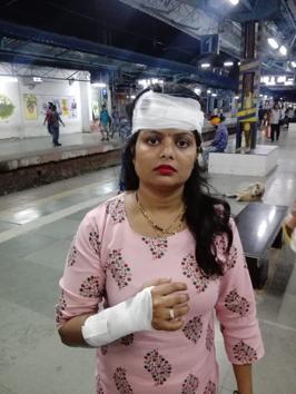 Asha Patil, 32, was one of the injured women.(HT PHOTO)