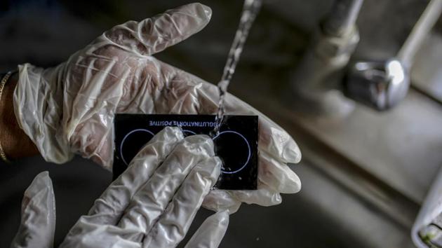 A worker washes the test slide of an agglutination kit in a medical lab at a Sudar Hospitals clinic. India has witnessed widespread droughts in four of the past five years, and the government forecasts that per head availability of water will fall by 35% next year from 2001 levels. Hospitals, which rely on water for sanitation and preventing infections, are suffering as the cost of water rises. (Dhiraj Singh / Bloomberg)